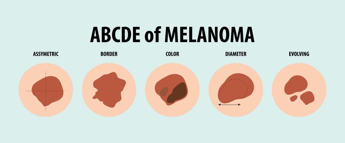 Shutterstock_2372862415