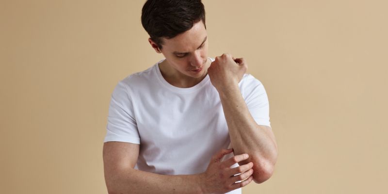 psoriasis treatments RI